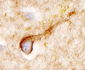 Somatostatin R2/SSTR2 antibody in Human Brain by Immunohistochemistry (IHC-P).