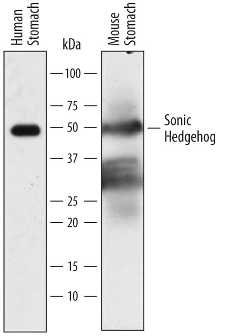 Detection of Human and Mouse Sonic Hedgehog/Shh antibody by Western Blot.