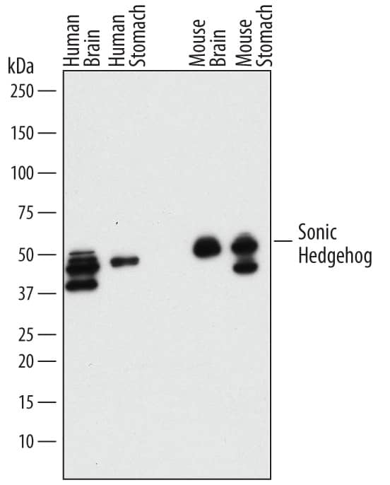 Detection of Human and Mouse Sonic Hedgehog/Shh antibody by Western Blot.