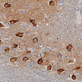 SorCS2 antibody in Human Brain by Immunohistochemistry (IHC-P).
