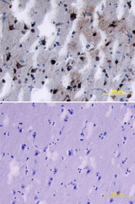 SorLA antibody in Human Brain by Immunohistochemistry (IHC-P).