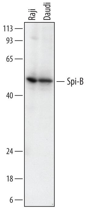 Detection of Human Spi-B antibody by Western Blot.