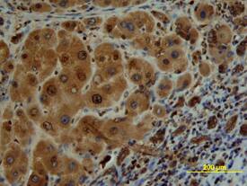 Src antibody in Human Liver by Immunohistochemistry (IHC-P).