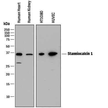 Detection of Human Stanniocalcin 1/STC-1 antibody by Western Blot.