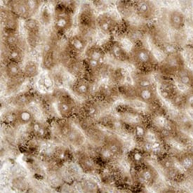 Stathmin‑2/STMN2 in Human Liver. Stathmin-2/STMN2 antibody in Human Liver by Immunohistochemistry (IHC-P).