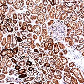 Sulfamidase/SGSH antibody in Human Kidney by Immunohistochemistry (IHC-P).