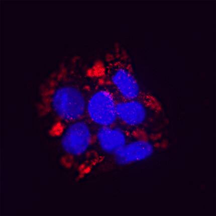 Sulfamidase/SGSH antibody in HT-29 Human Cell Line by Immunocytochemistry (ICC).