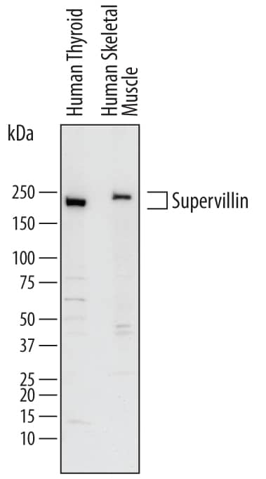 Detection of Human Supervillin antibody by Western Blot.