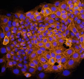 Syndecan-1/CD138 antibody in NMuMG Mouse Cell Line by Immunocytochemistry (ICC).