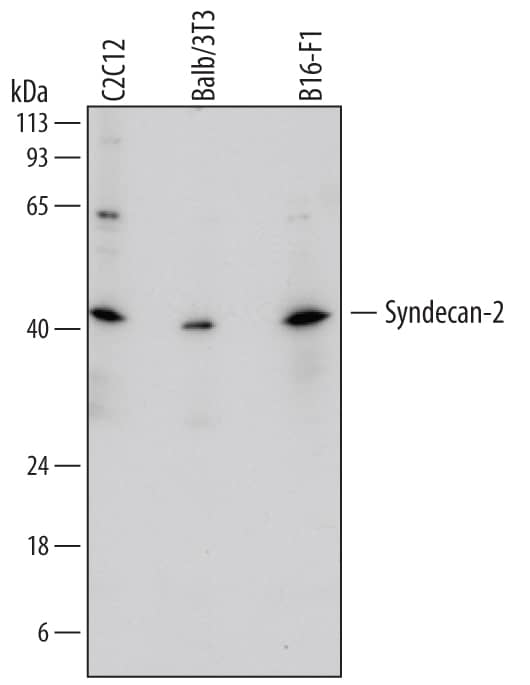 Detection of Mouse Syndecan-2/CD362 antibody by Western Blot.