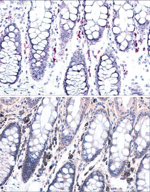 Syndecan-1/CD138 antibody in Human Colon Using Dual RNAscope®ISH and IHC.