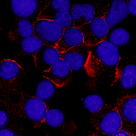 Syndecan-1/CD138 antibody in U266 Human Cell Line by Immunocytochemistry (ICC).