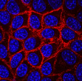 Syndecan-1/CD138 antibody in NMuMG Mouse Cell Line by Immunocytochemistry (ICC).