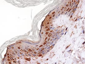 Syndecan-2/CD362 antibody in Human Skin by Immunohistochemistry (IHC-P).