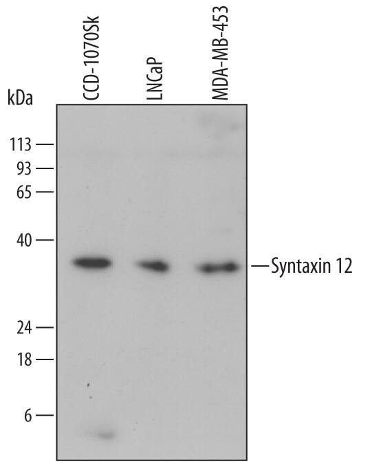 Detection of Human Syntaxin 12 antibody by Western Blot.