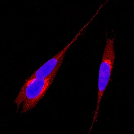 Syntaxin 5 antibody in SH-SY5Y Human Cell Line by Immunocytochemistry (ICC).