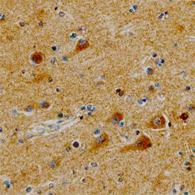 Syntaxin 6 antibody in Human Brain by Immunohistochemistry (IHC-P).