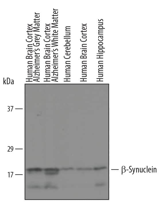 Detection of Human  beta-Synuclein antibody by Western Blot.