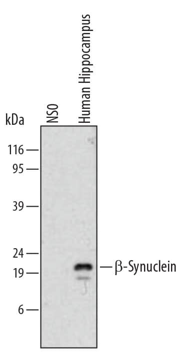 Detection of Human  beta-Synuclein antibody by Western Blot.