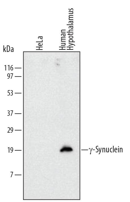 Detection of Human ?-Synuclein antibody by Western Blot.