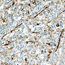 a-Synuclein antibody in Human Brain by Immunohistochemistry (IHC-P).