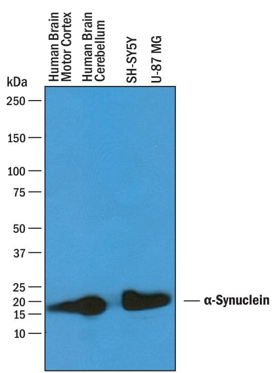 Detection of Human a-Synuclein antibody by Western Blot.