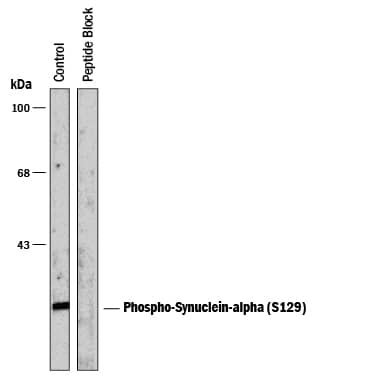 Detection of Phospho-Synuclein-a (S129) antibody by Western Blot