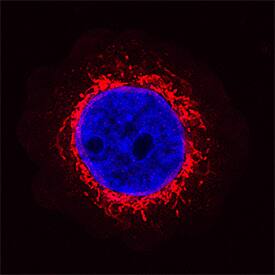 ?-Synuclein antibody in MBA-MB-468 Human Cell Line by Immunocytochemistry (ICC).