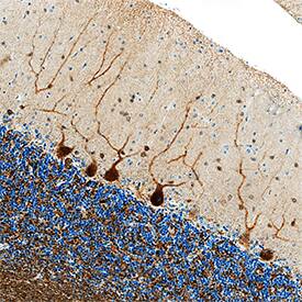 ?-Synuclein antibody in Human Brain by Immunohistochemistry (IHC-P).