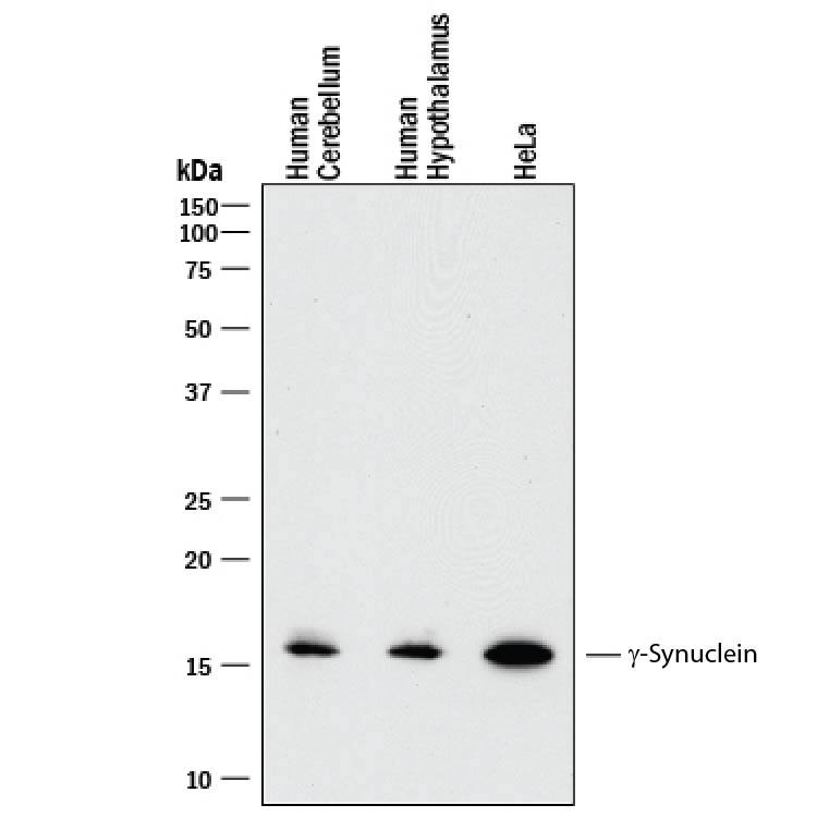 Detection of Human ?-Synuclein antibody by Western Blot.