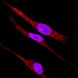 TAB1 antibody in HeLa Human Cell Line by Immunocytochemistry (ICC).