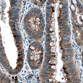 TACE/ADAM17 antibody in Human Colon by Immunohistochemistry (IHC-P).