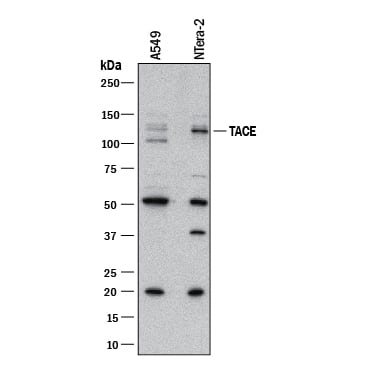 Detection of Human TACE/ADAM17 antibody by Western Blot.