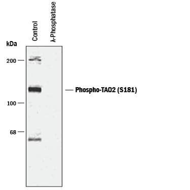 Detection of Phospho-TAO2 (S181) antibody by Western Blot.