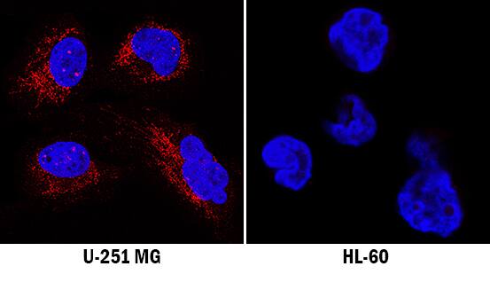 TAP2 antibody in U-251 MG and HL-60 Human Cell Line by Immunocytochemistry (ICC).