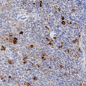 TAP2 antibody in Human Tonsil by Immunohistochemistry (IHC-P).