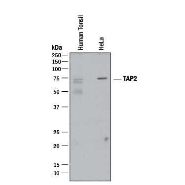 Detection of Human TAP2 antibody by Western Blot.