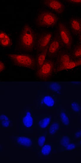 TBX18 antibody in Saos-2 Human Cell Line by Immunocytochemistry (ICC).