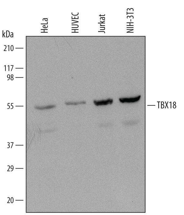 Detection of Human and Mouse TBX18 antibody by Western Blot.