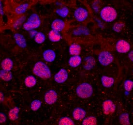 TBX20 antibody in BG01V Human Embryonic Stem Cells by Immunocytochemistry (ICC).