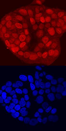 TBX2 antibody in MCF-7 Human Cell Line by Immunocytochemistry (ICC).