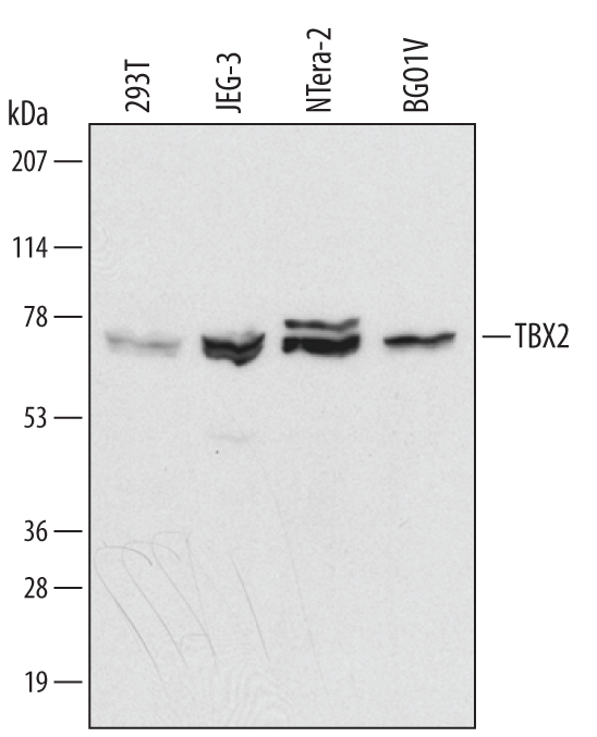 Detection of Human TBX2 antibody by Western Blot.