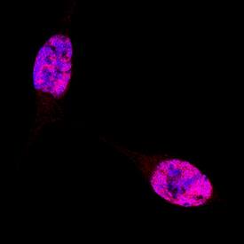 TBX3 antibody in LNCaP Human Cell Line by Immunocytochemistry (ICC).