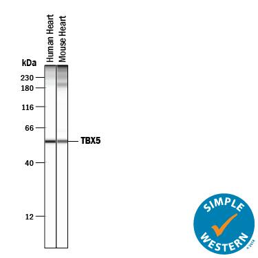 Detection of Human and Mouse TBX5 antibody by Simple WesternTM.