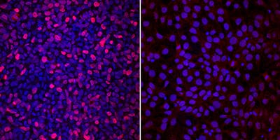 TBX6 antibody in JOY6 Human iPS Cells by Immunocytochemistry (ICC).