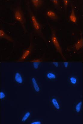 TCF-3/E2A antibody in HeLa Human Cell Line by Immunocytochemistry (ICC).