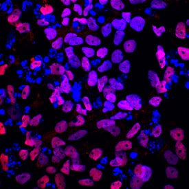 TCF-2/HNF-1 beta antibody in BG01V Human Embryonic Stem Cells by Immunocytochemistry (ICC).