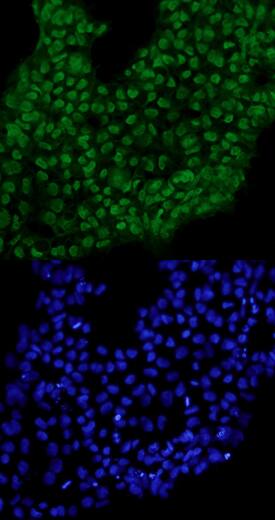 TCF7L1 antibody in BG01V Human Stem Cells by Immunocytochemistry (ICC).