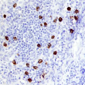 TCL1B antibody in Human Lymphoma by Immunohistochemistry (IHC-P).