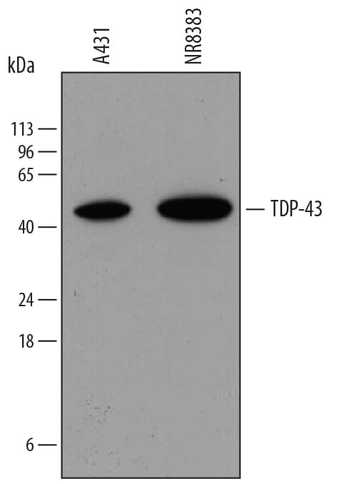 Detection of Human TDP-43/TARDBP antibody by Western Blot.